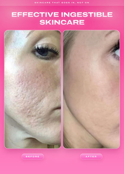 It Girl Skin | Strawberry Beauty Gummies