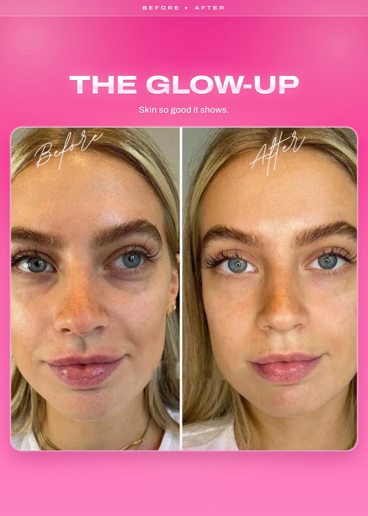 It Girl Skin | Strawberry Beauty Gummies